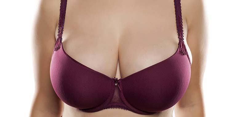After her breast reduction surgery, a female patient wears a dark red bra.