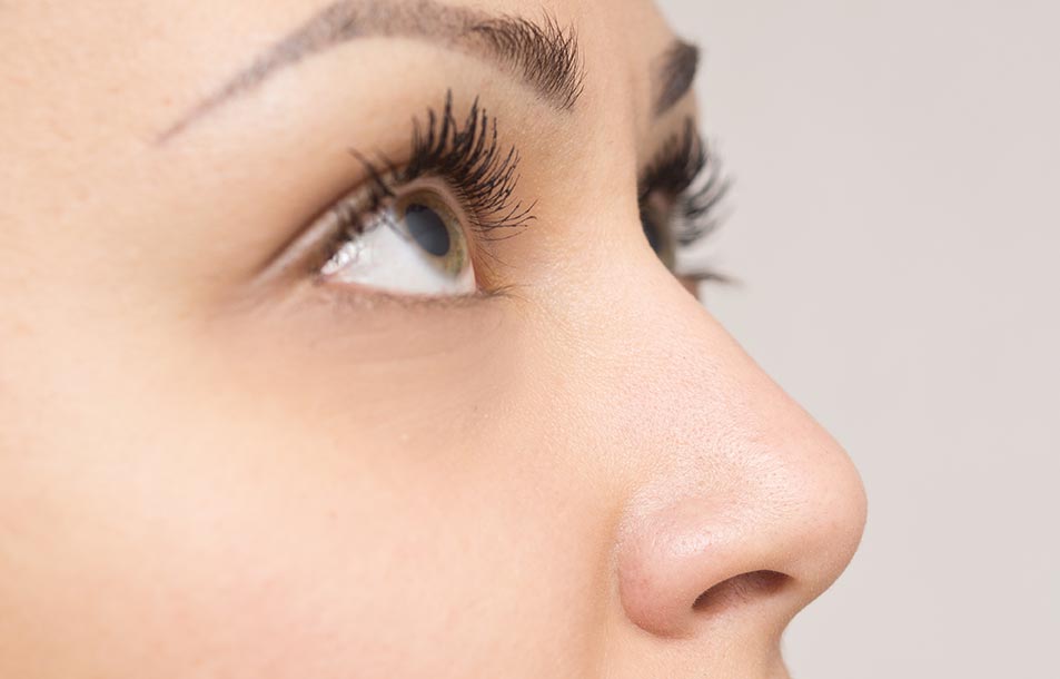 A woman with a nose job poses for a photograph